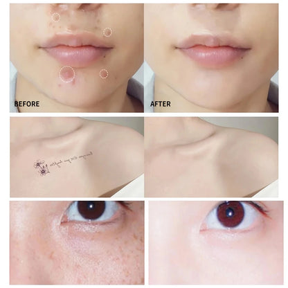 Long-Lasting & Brightening Cream for Face, Scars & Tattoos